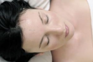acupuncture-headaches-migraines
